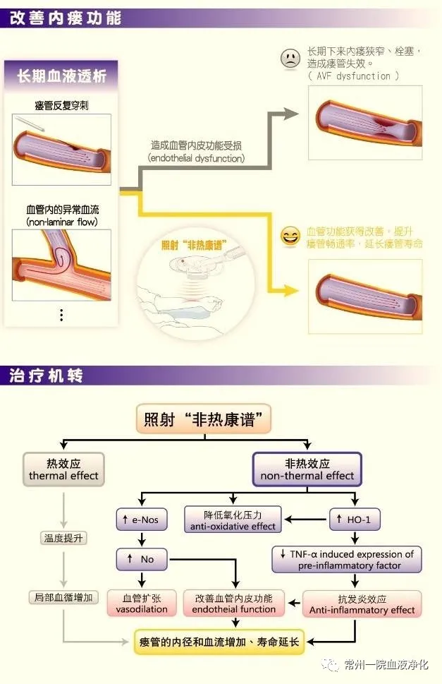 血液透析好幫手-非熱康譜血透内瘘治療儀